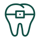 Ceramic Veneers